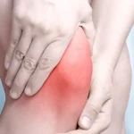 روش های درمان آرتروز زانو